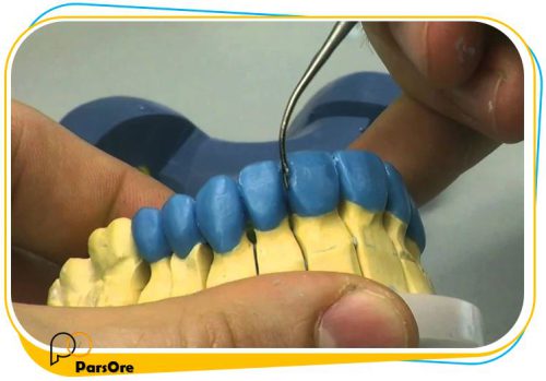 موم دندانپزشکی دندان سازی
