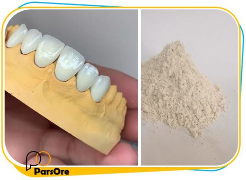 پودر گچ آلفا پلستر برای ساخت قالب دندان سازی در لابراتوار